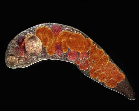  Echinostomosis - Parasite with Parasitic Prowess: Exploring the Hidden World of This Tiny Trematode